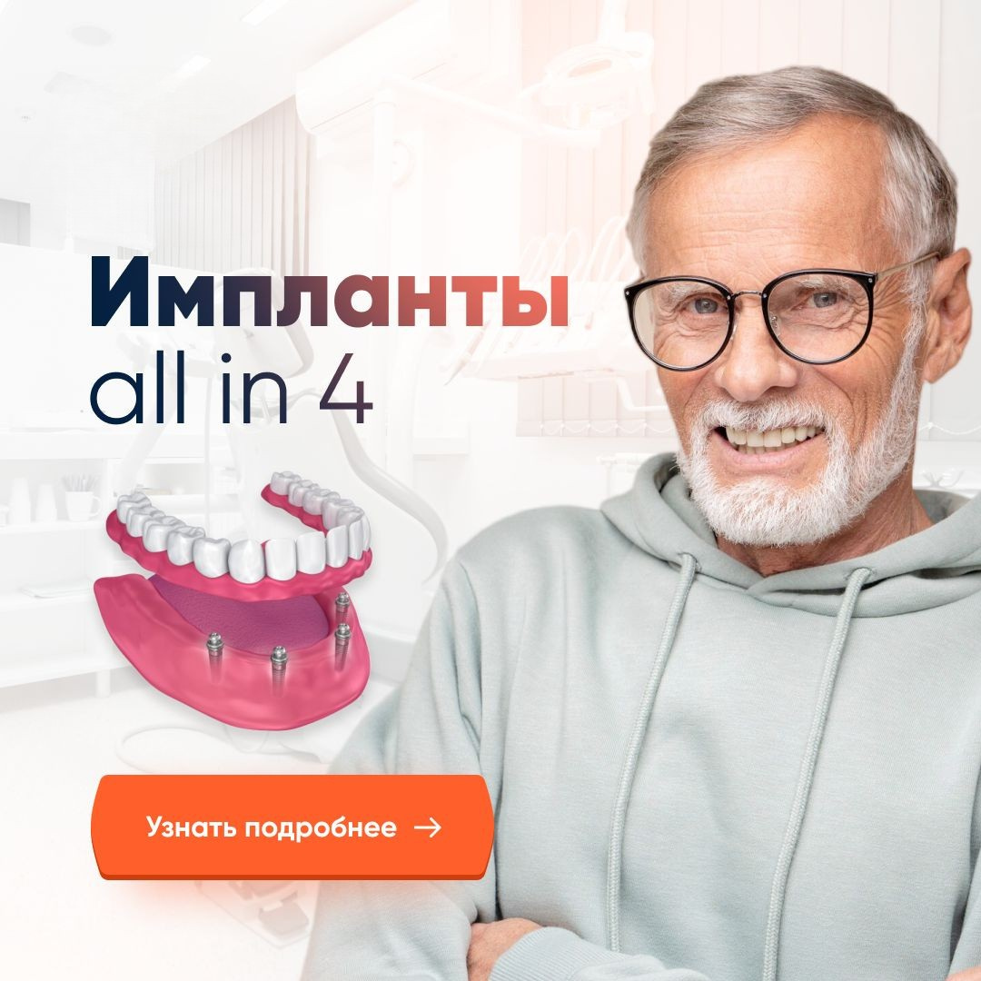 Импланты All in 4 в Чехии