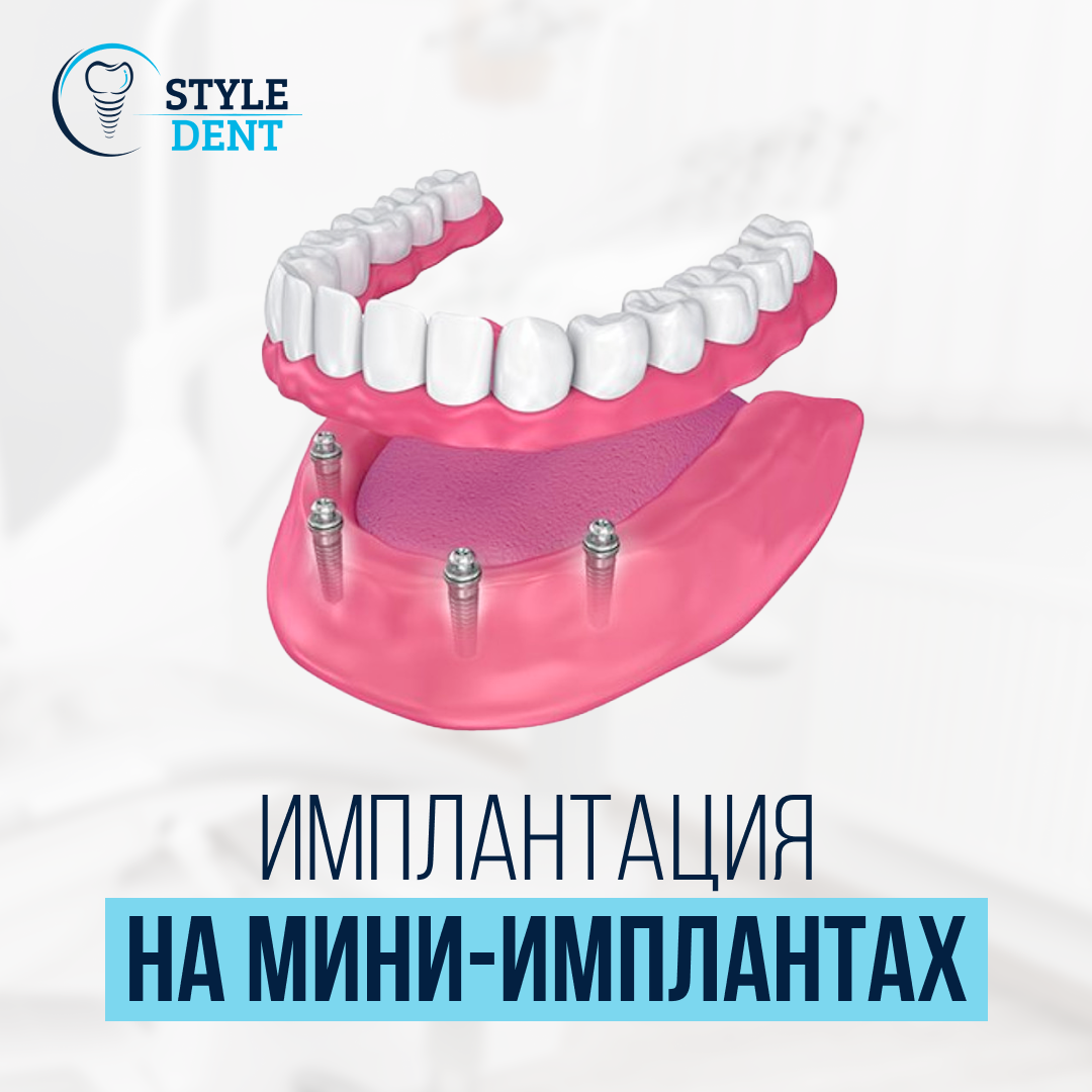 Style Dent